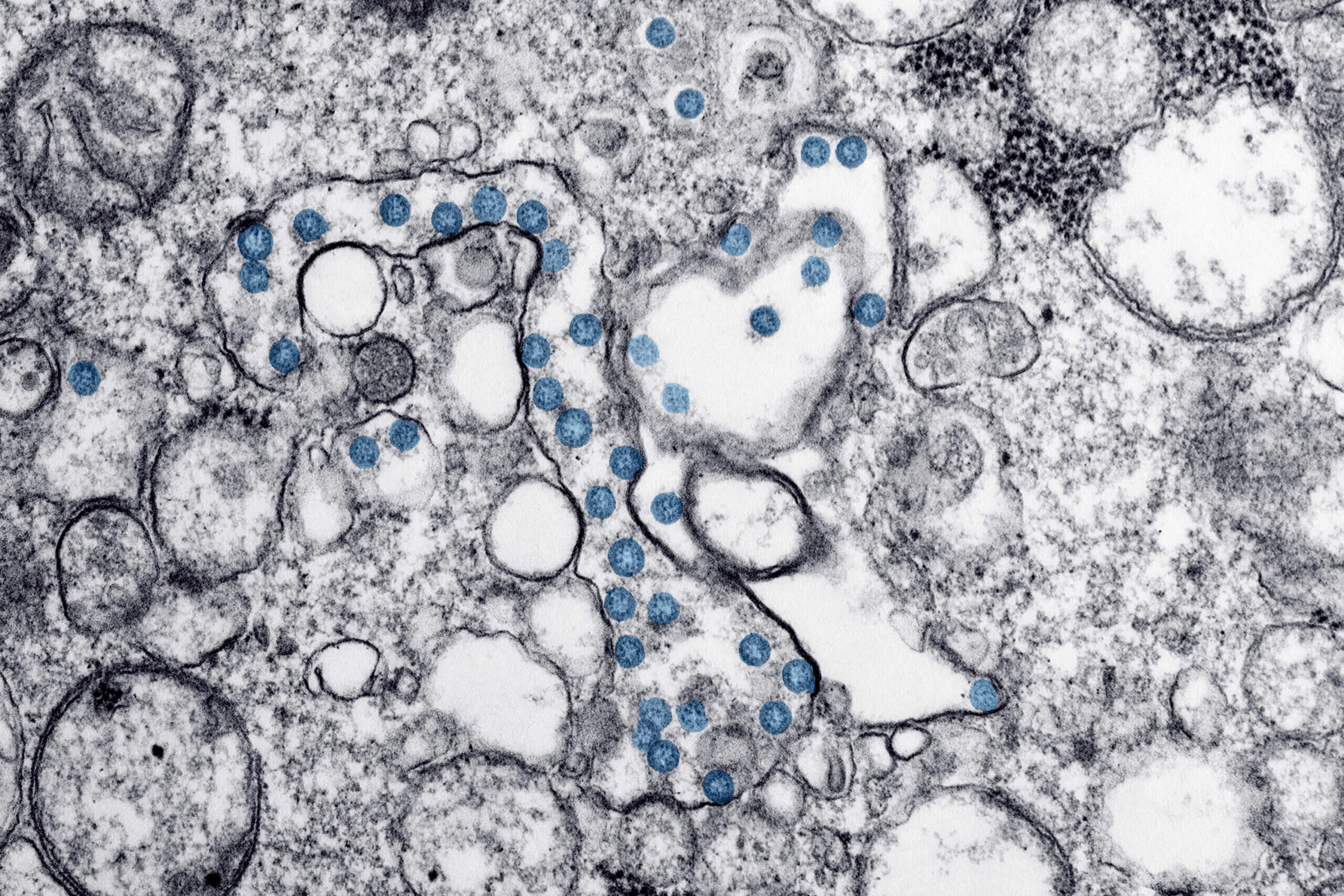 Delta variant remains major coronavirus threat