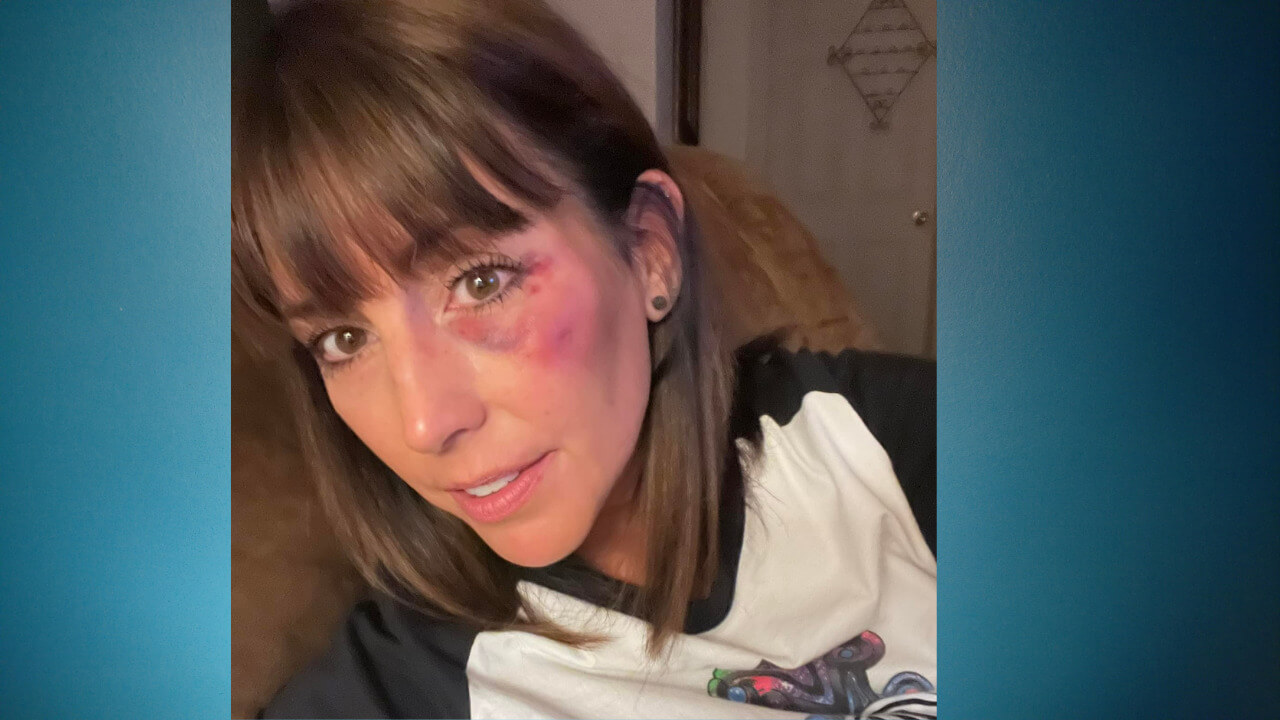 Mississippi umpire assaulted after 12 year old softball game DeSoto